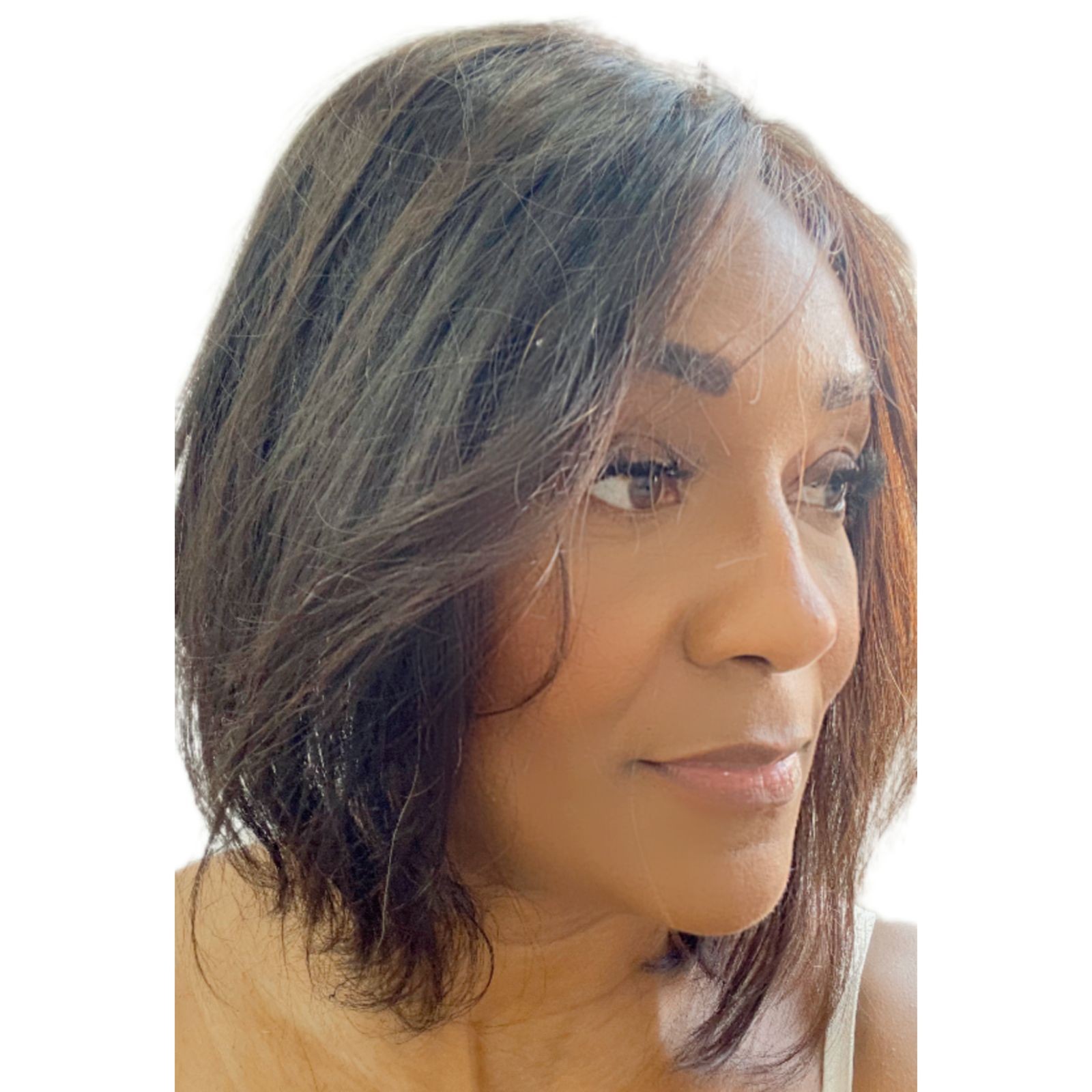 Prótese Frontal Capilar orelha á orelha