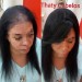 calvicie feminina