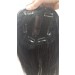 alopecia